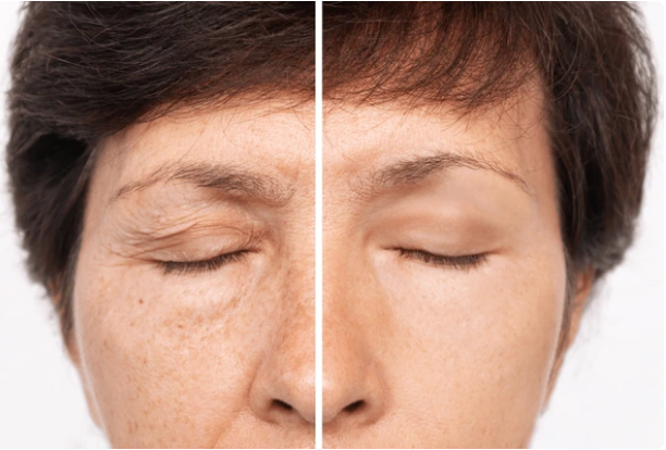 SERUM FACIAL ANTI-ARRUGAS